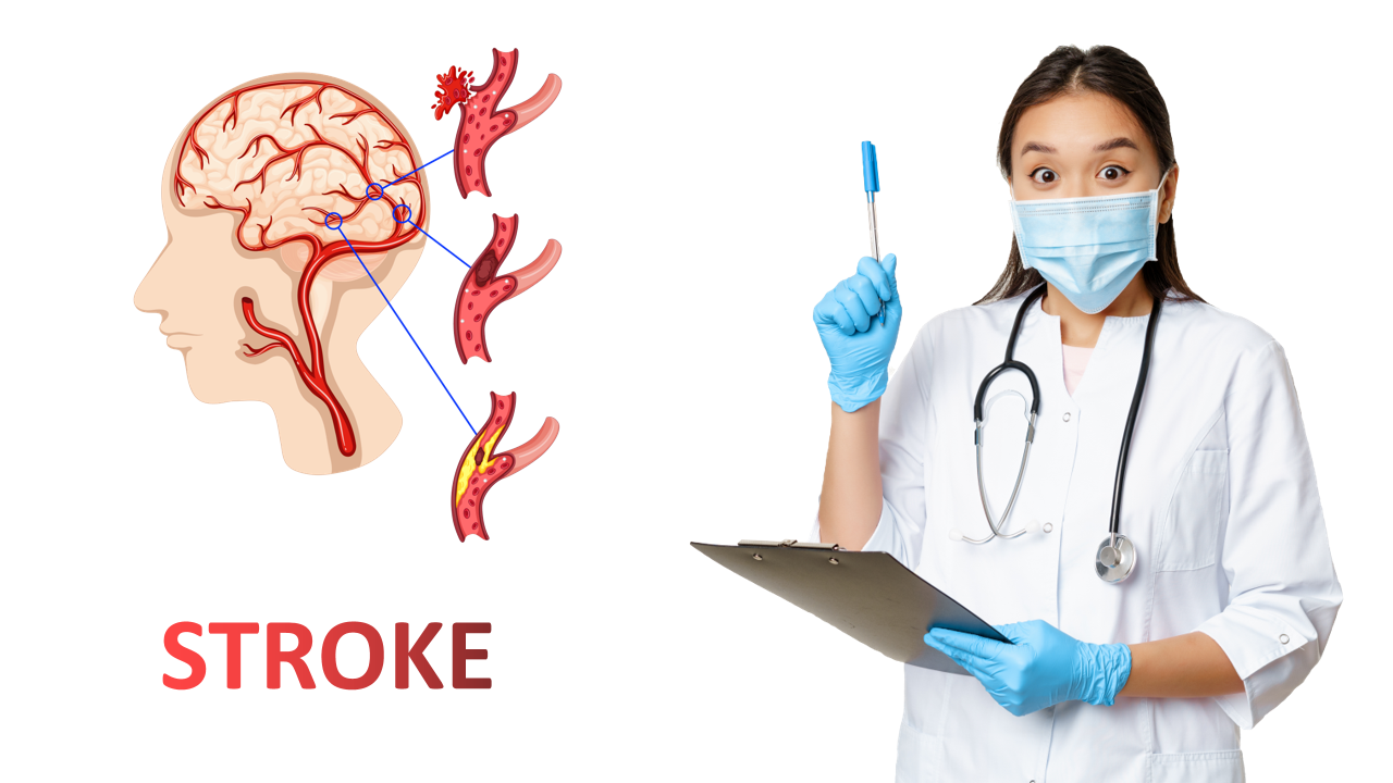 Hati-hati Remaja Berpotensi Terserang Stroke, Kenali Penyebabnya !